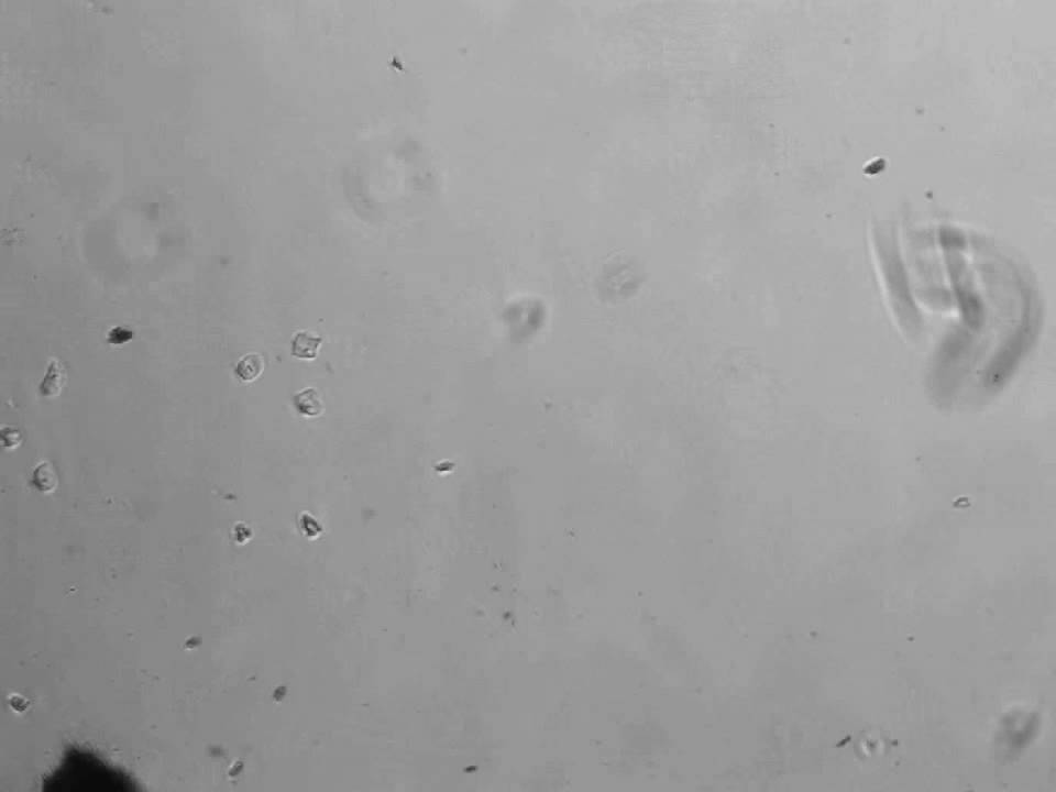 Schistosoma Mansoni Cercariae