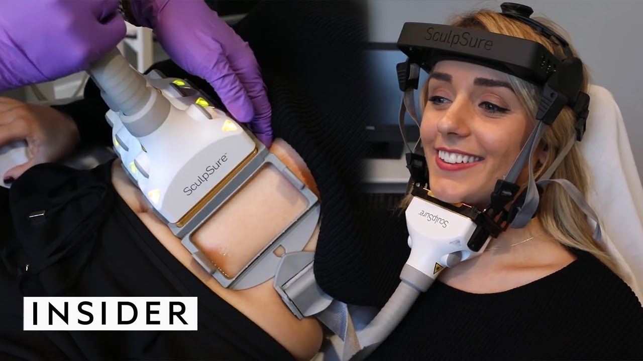 SculpSure | Machine Melts All Your Body Fat featured on Insider