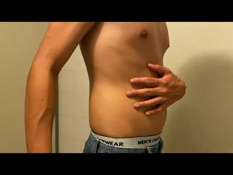 Sep 18, 2020 Belly Bloating Part 1
