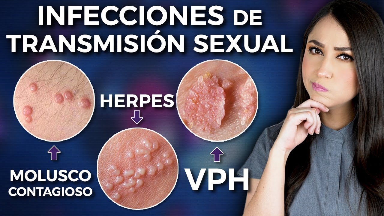 Sexually transmitted diseases⚠️ l Everything you need to know 👩🏻‍⚕️
