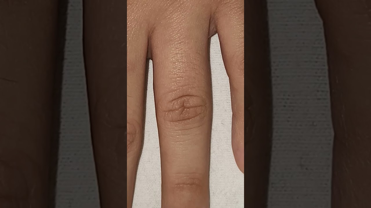 #shortsviral #finger #crush