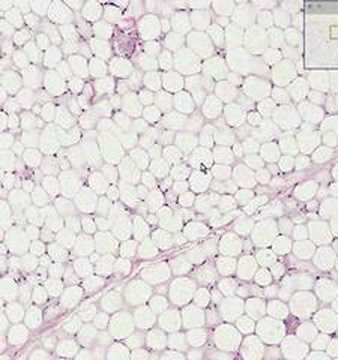 Shotgun Histology Adipose Tissue
