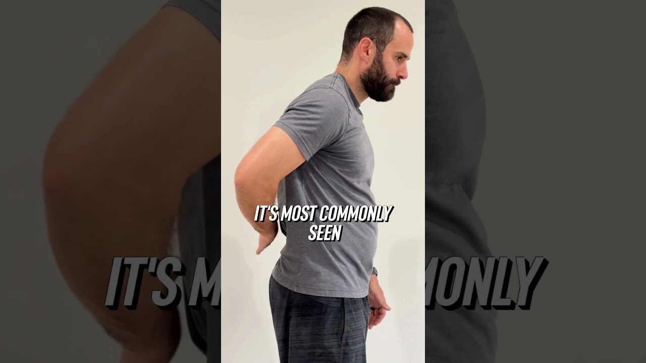 Shoulder Pain? Quick Tests to Identify Impingement, Tendonitis, or a Tear! #shorts