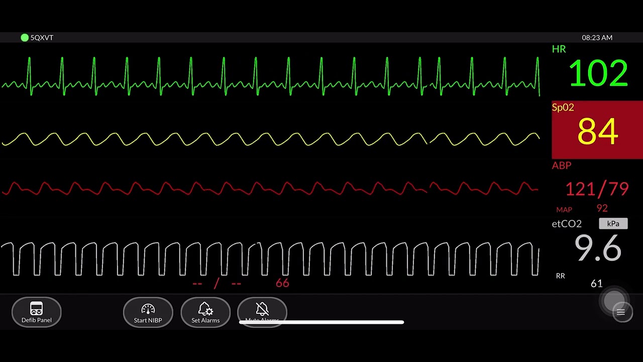 Simulated Patient Monitor