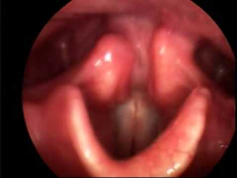 Singing Vocal Folds