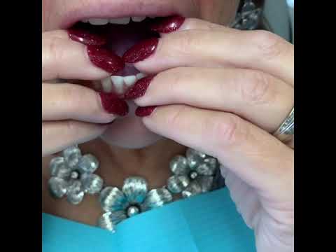 Snap-on Dentures