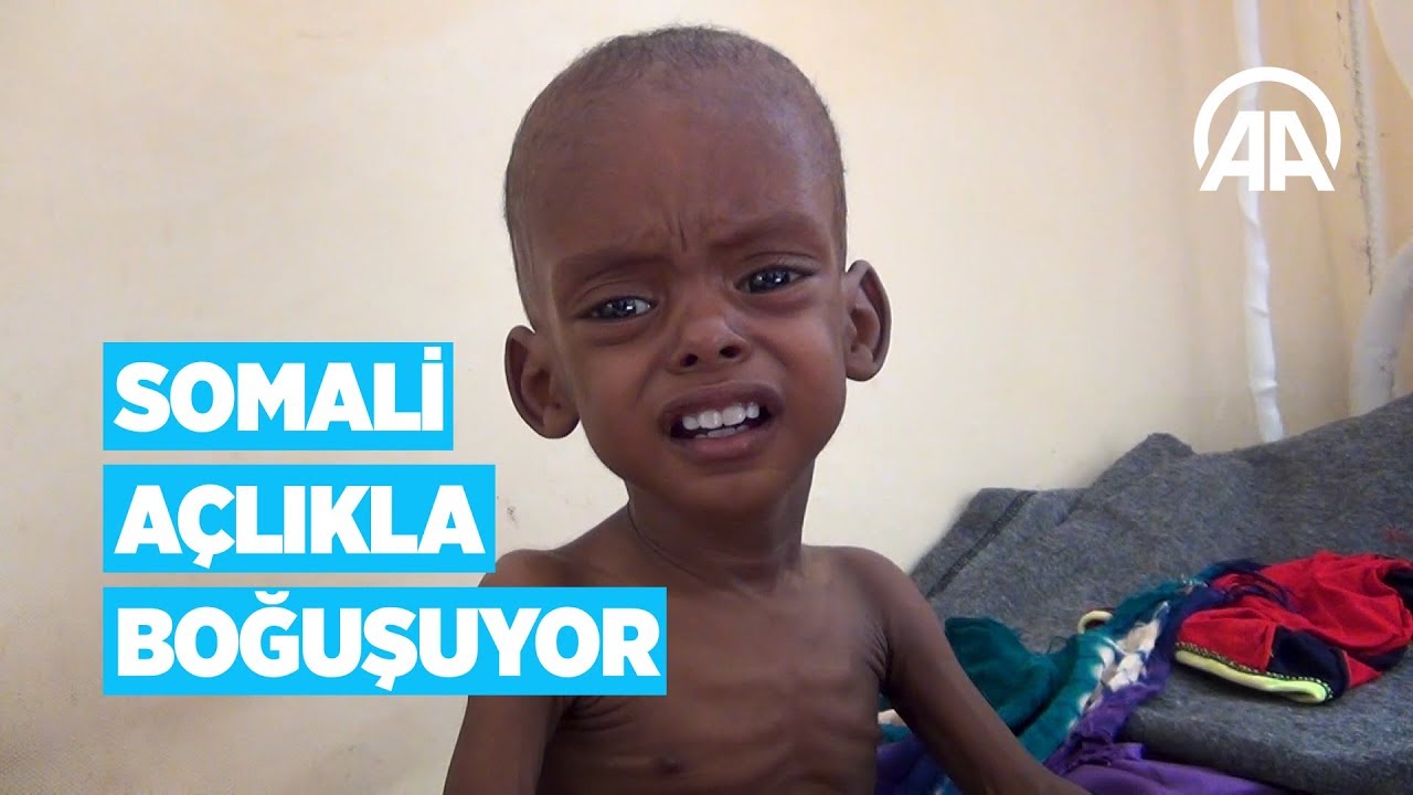 Somali açlıkla boğuşuyor