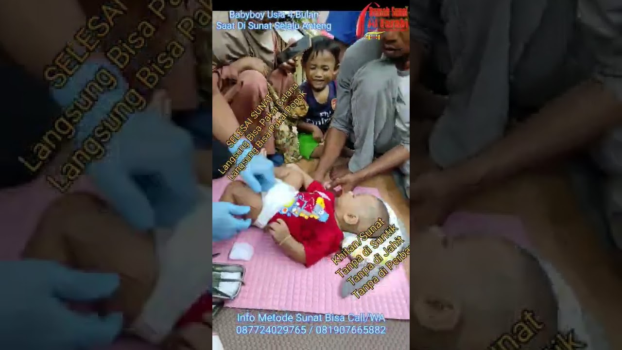 Spesialis Sunat Bayi