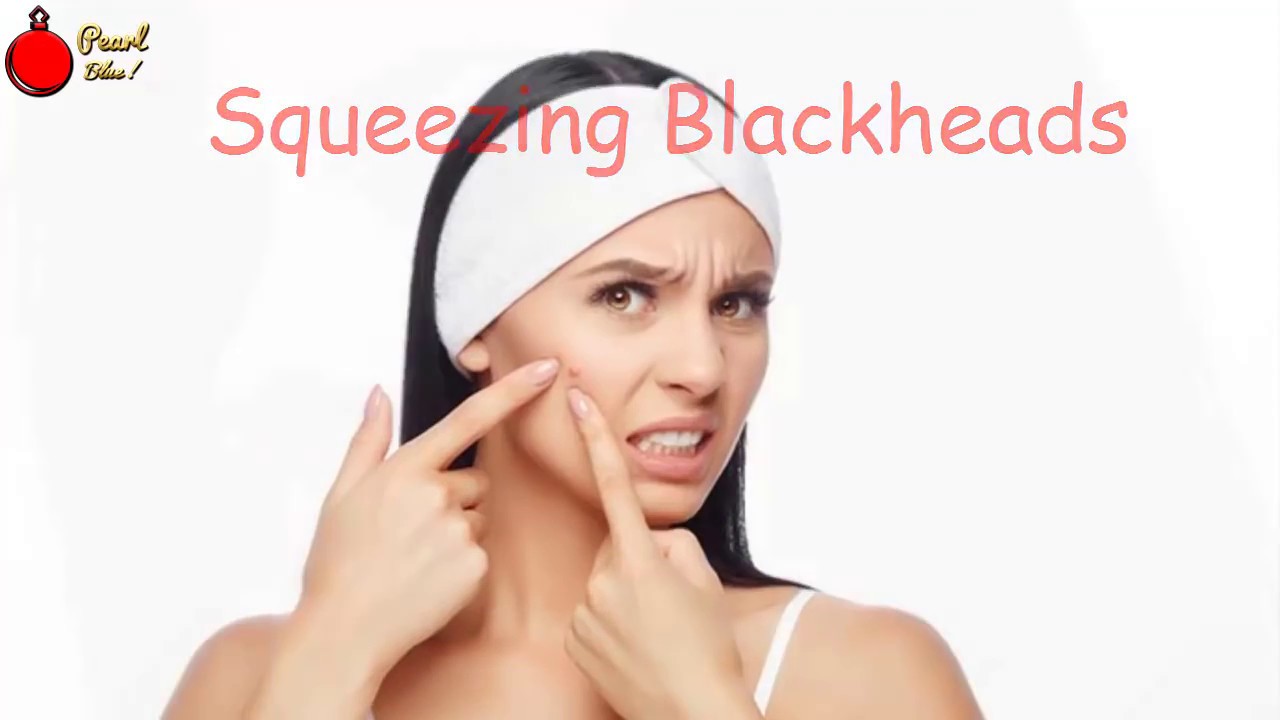 Squeezing Blackheads Possibly the most annoying skin condition