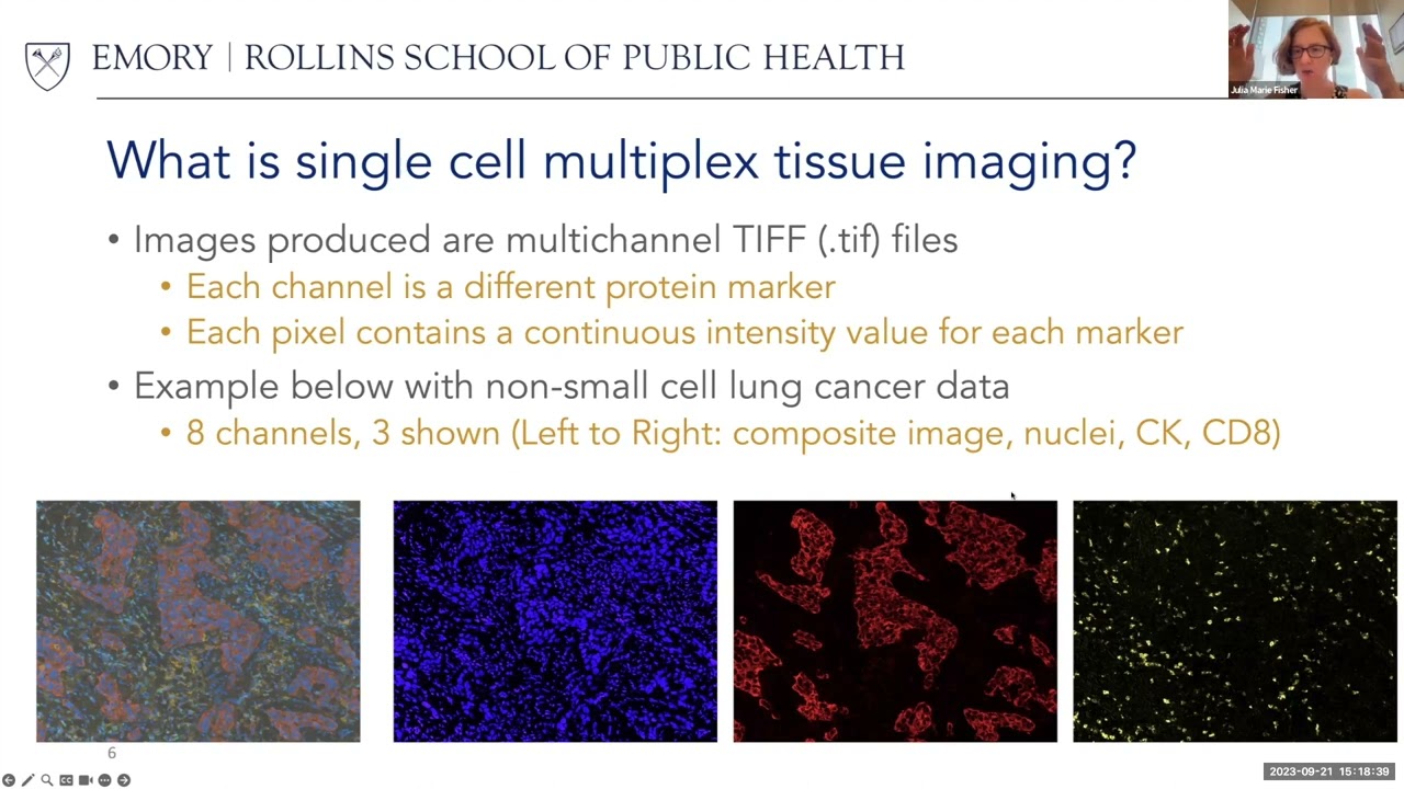 Statistical Analysis of Multiplex Single-Cell Imaging Data - Julia Wrobel