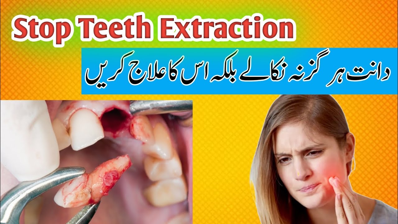 Stop Teeth Extraction||Daant Har giz mat na nekale uska elaj kare...