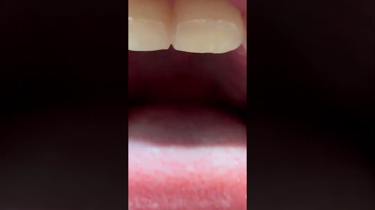 Sub for more future content #mouth #tongue #vore