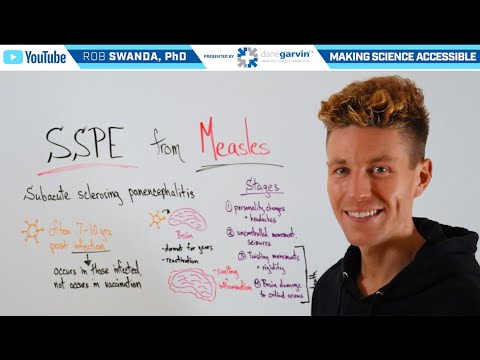 Subacute Sclerosing Panencephalitis (SSPE) from Measles