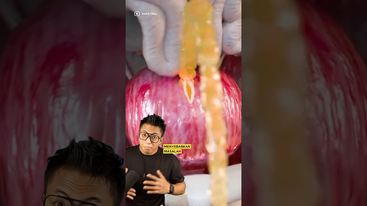 Suka Tahan Air Kencing?