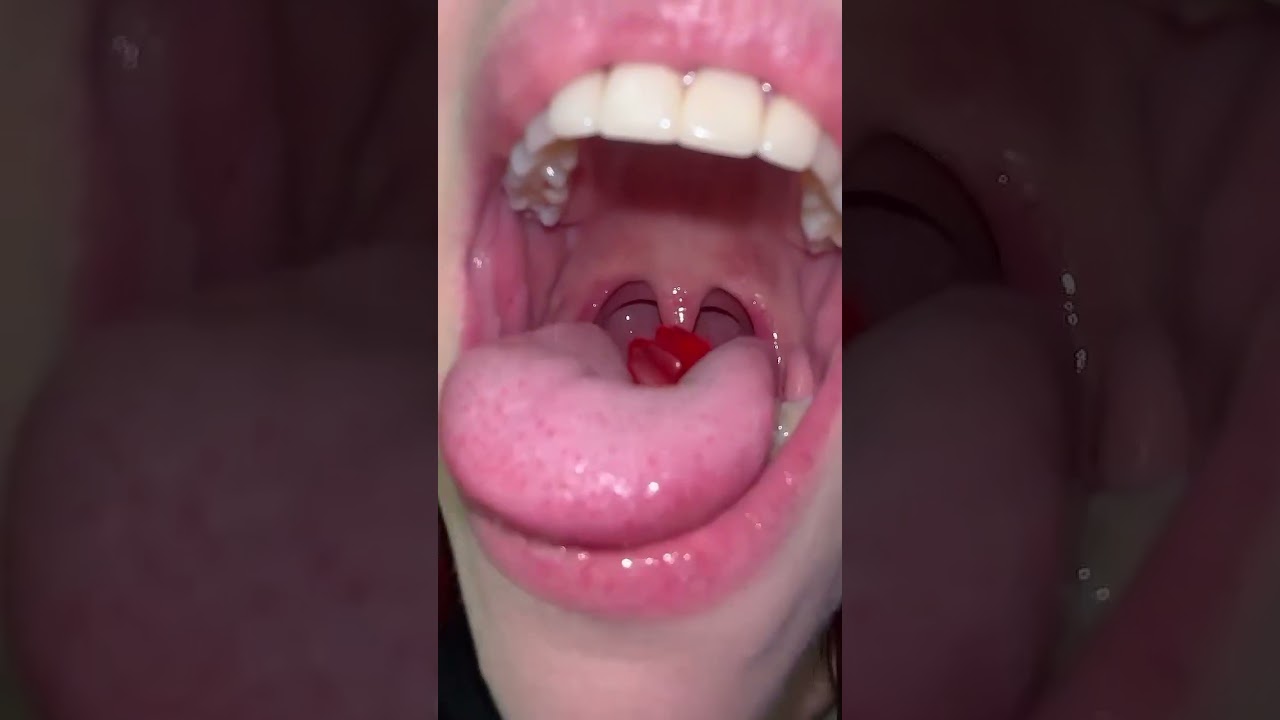 Swallowing gummy part 6
