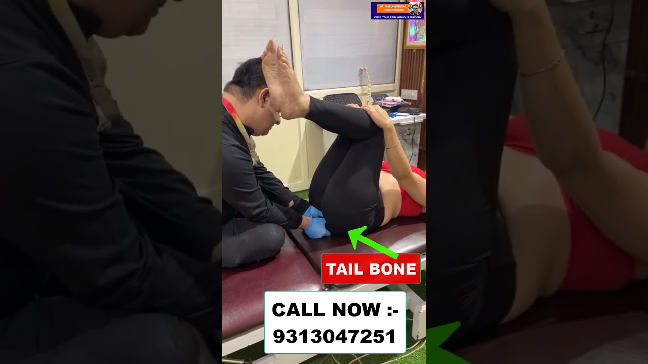 TAIL BONE Treatment | Chiropractic Treatment in India | Sitting Job | Dr. Varun | Call - 9313047251