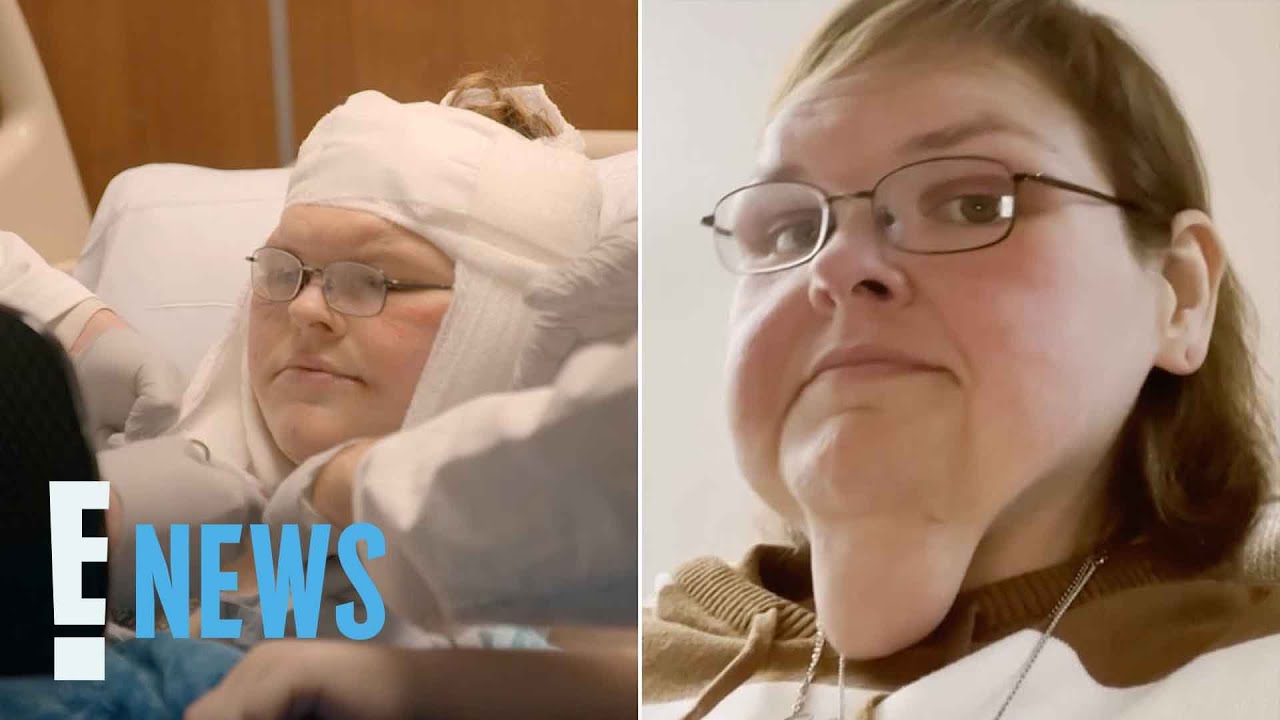 Tammy Slaton Reveals Skin Removal Surgery Results | E! News