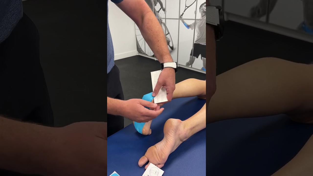 Taping for plantar fasciitis with Spidertech i-Strips