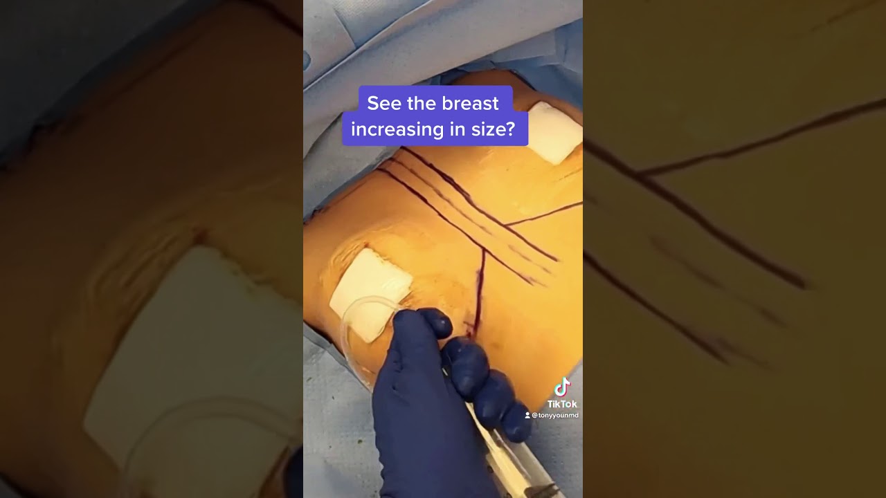 The awesome but sad life of a breast implant sizer #shorts