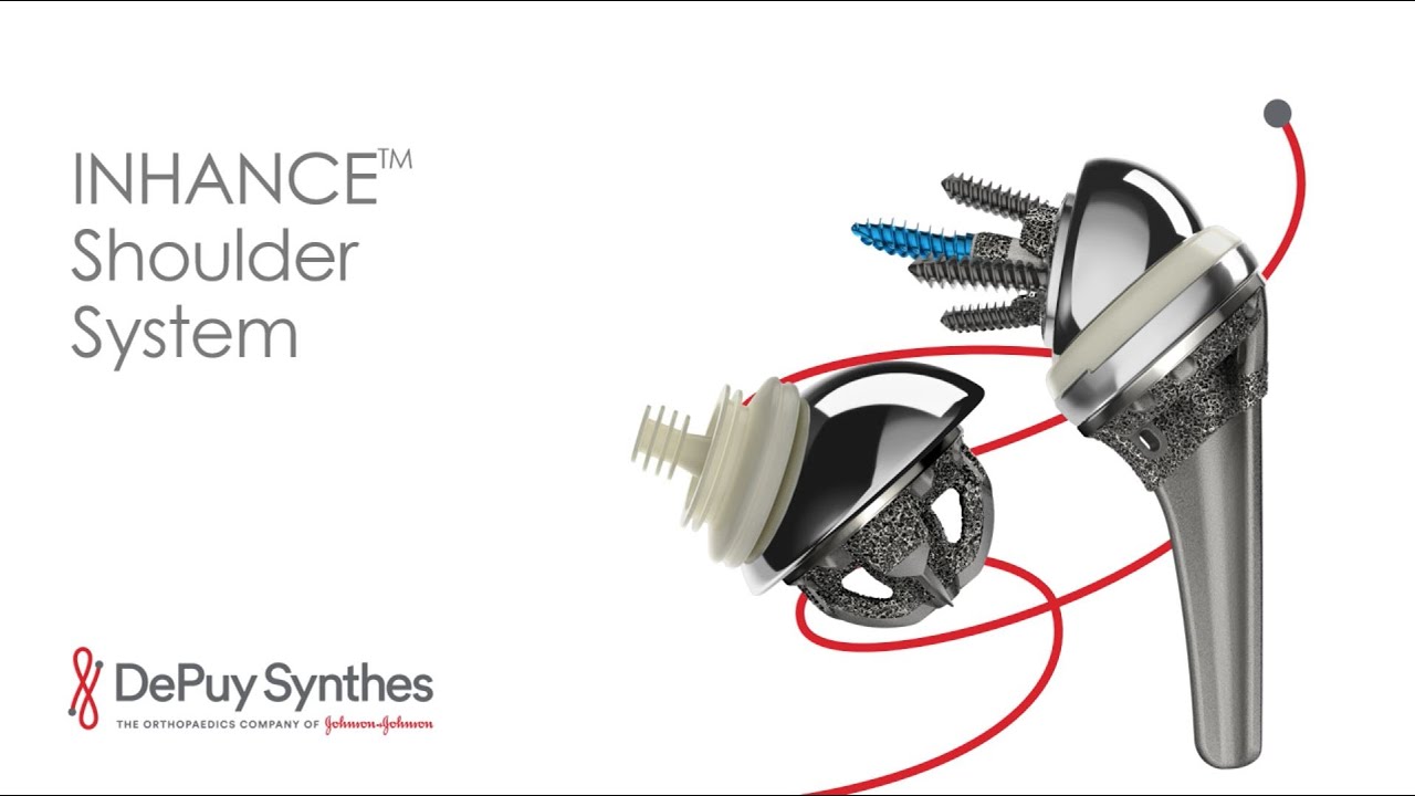 The DePuy Synthes INHANCE Shoulder System