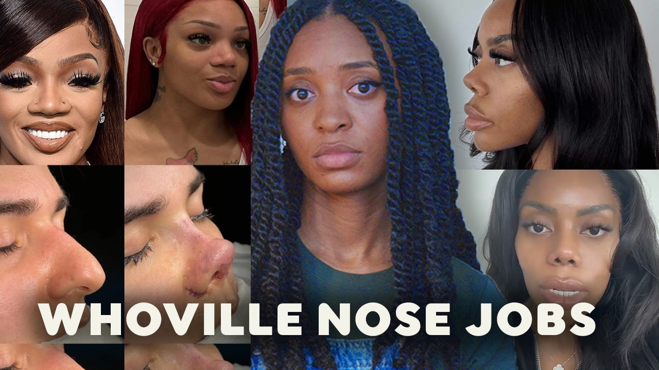 The Ethics Of An Ethnic Nose Job