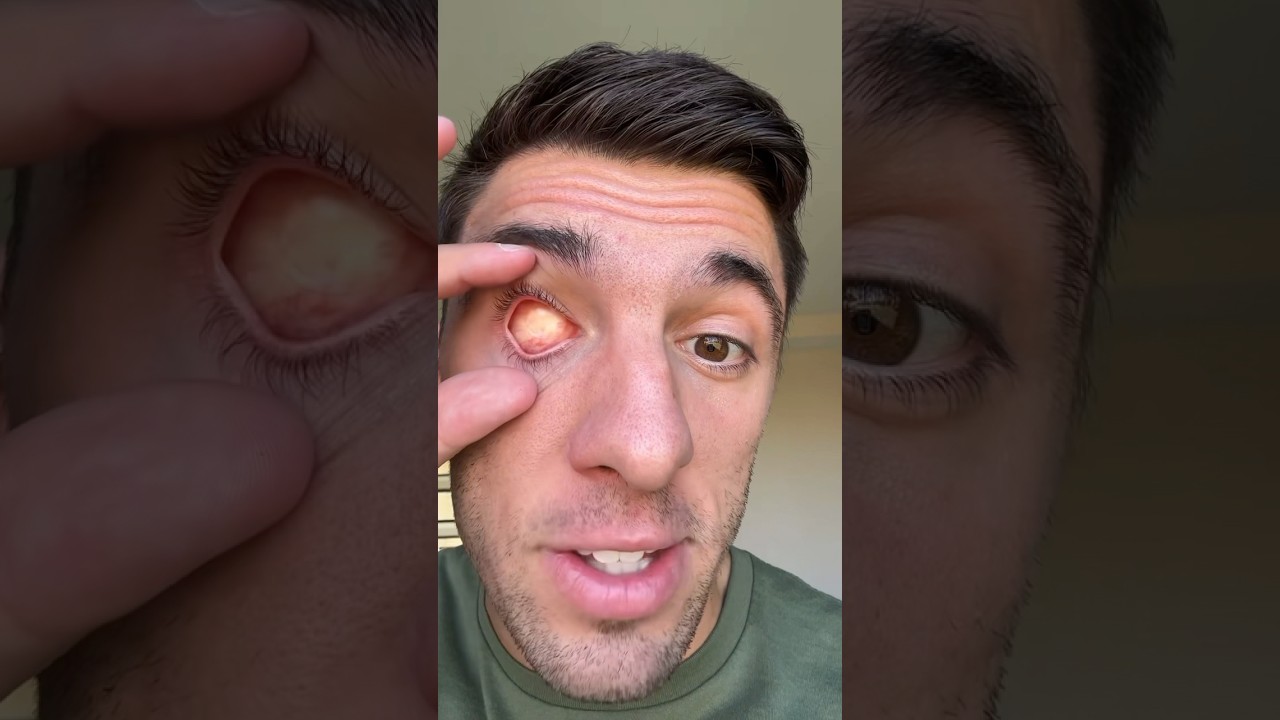 THE EYEBALL I WEAR THE MOST 😮