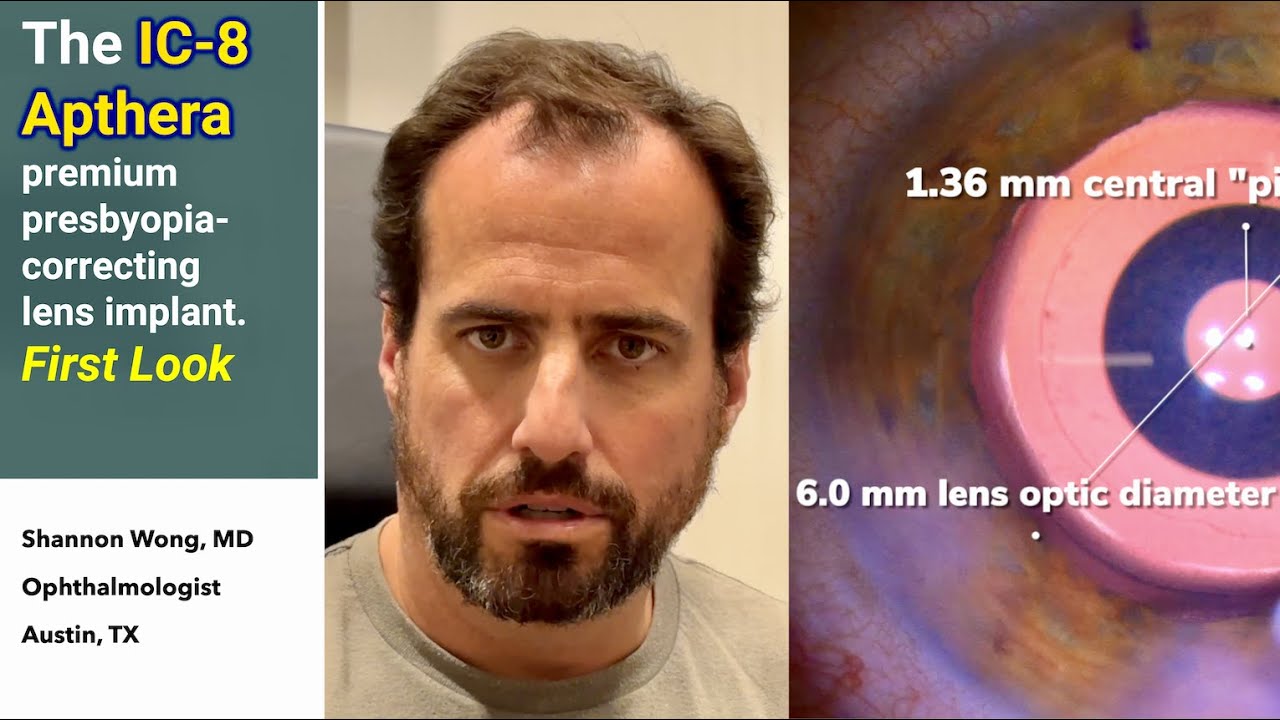 The IC-8 Apthera lens for premium cataract & lens replacement. How well does it work? First look.