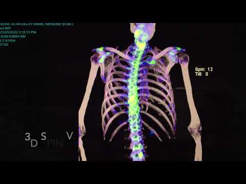 The nuclear medicine 
