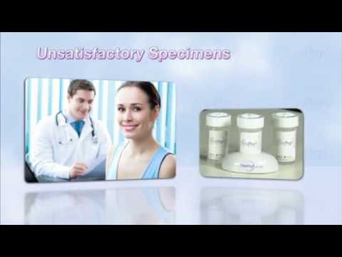 ThinPrep Pap Test Specimen Collection