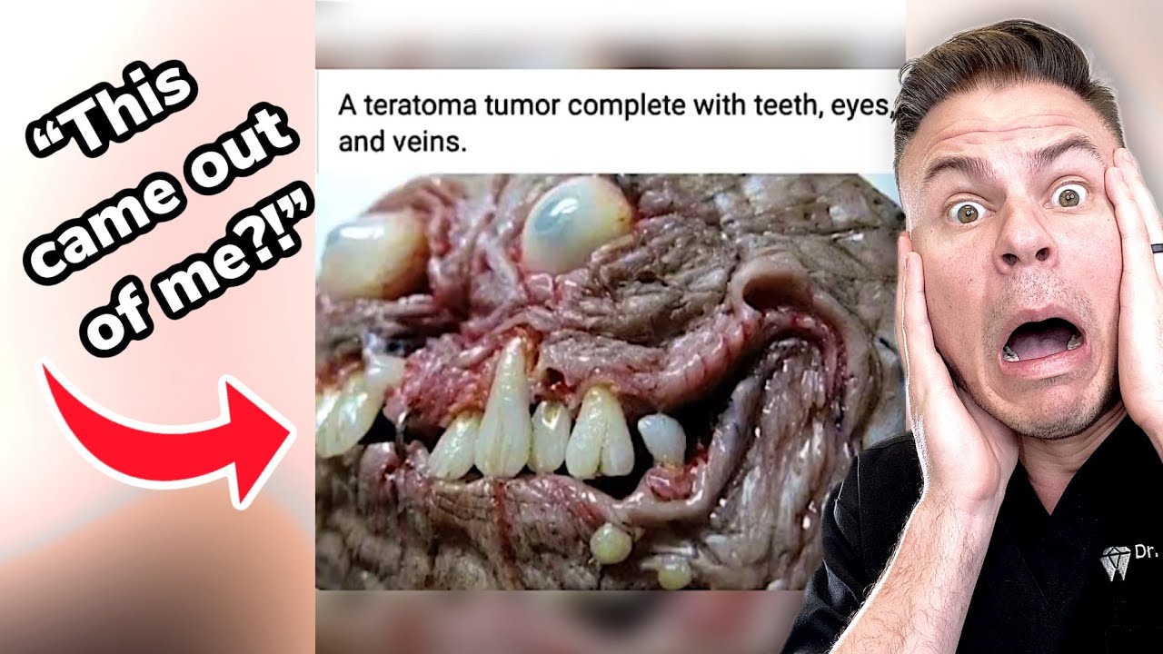 This Could Be Growing In Your Body 😳