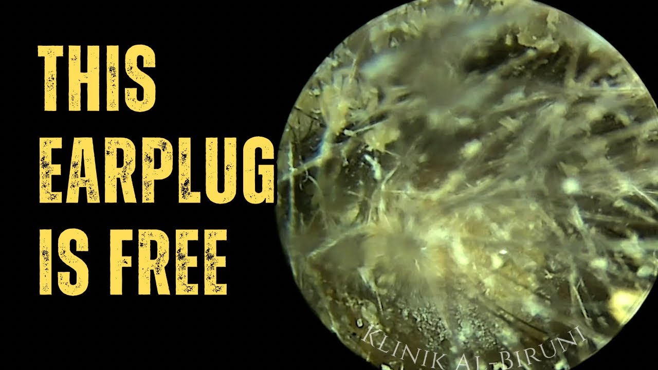 This Earplug Is FREE