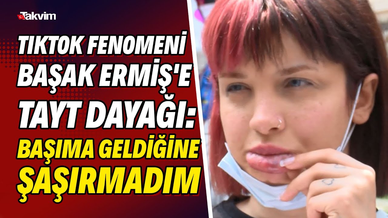 TikTok fenomeni Başak Ermiş'e oyuncu Can Topçu'dan tayt dayağı: Başıma geldiğine şaşırmadım
