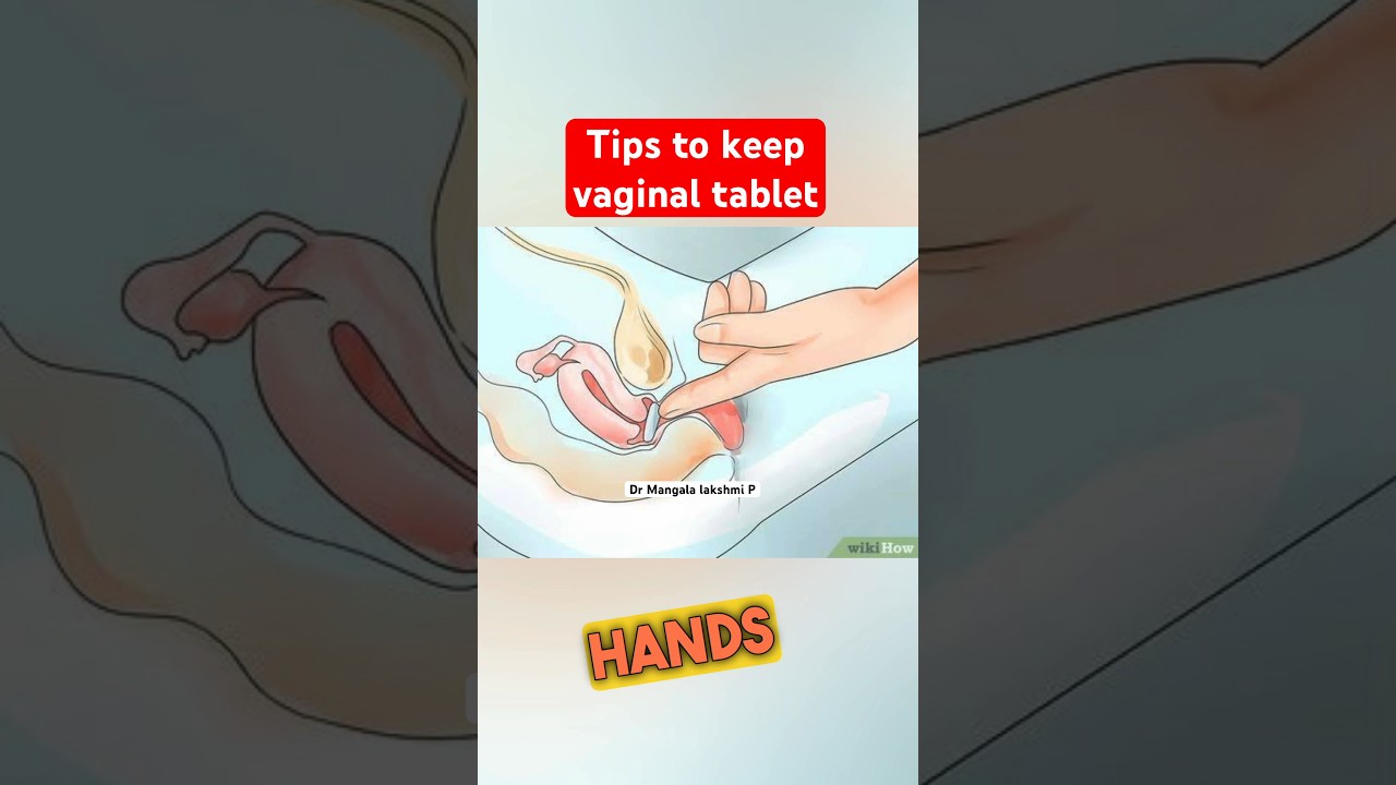 Tips to insert vaginal tablets  #fertility #doctor #pregnancy #ivf #hpvvaccine #madurai