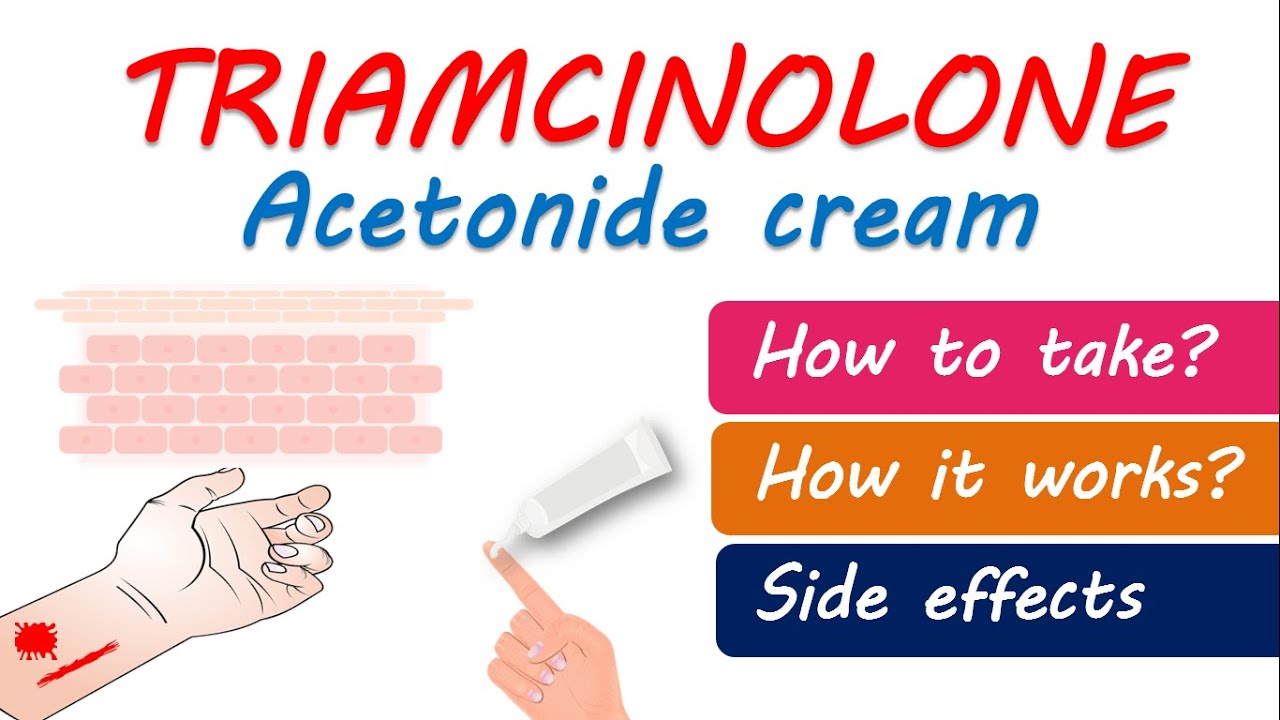 Triamcinolone acetonide cream USP 0.1 | How to use? Precautions and side effects