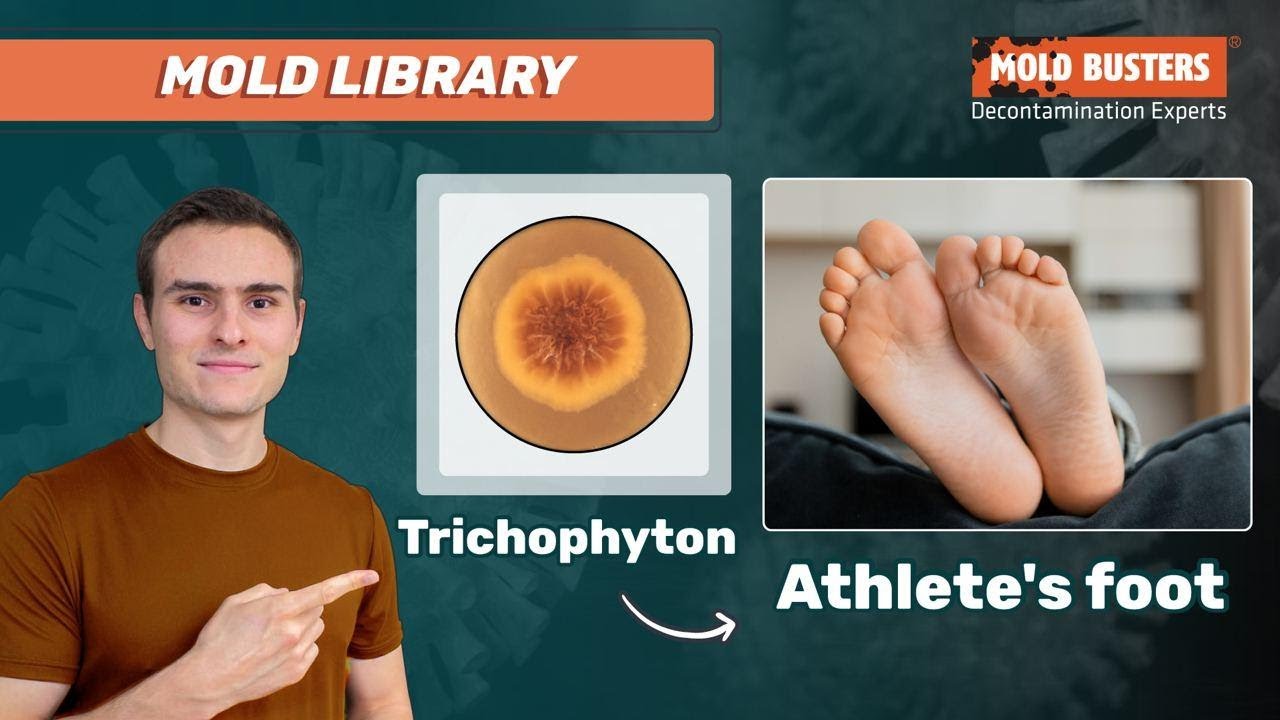 Trichophyton 🦠 - 📚Mold Library - Mold Busters