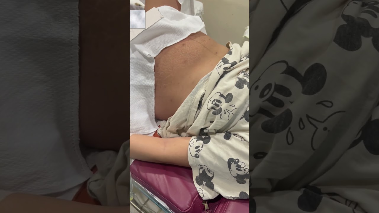 Tummy deflation when the baby out😱