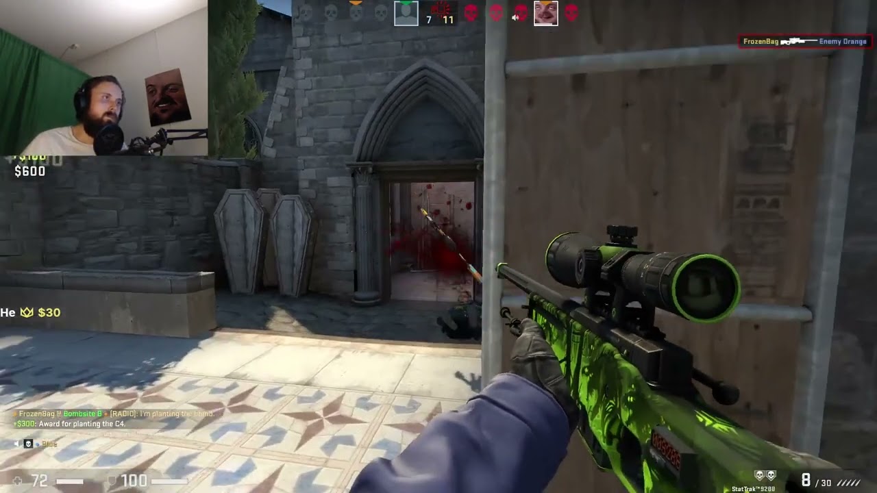 typical teammates in faceit during a clutch | FORSEN