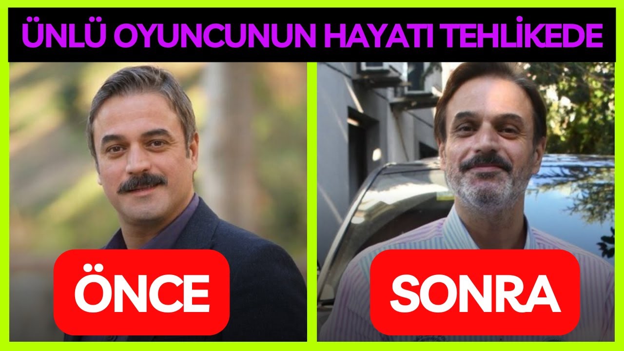 Ufuk Özkan'ın Sağlık Sorunları: Siroz Hastalığı ve Diyet İddiaları