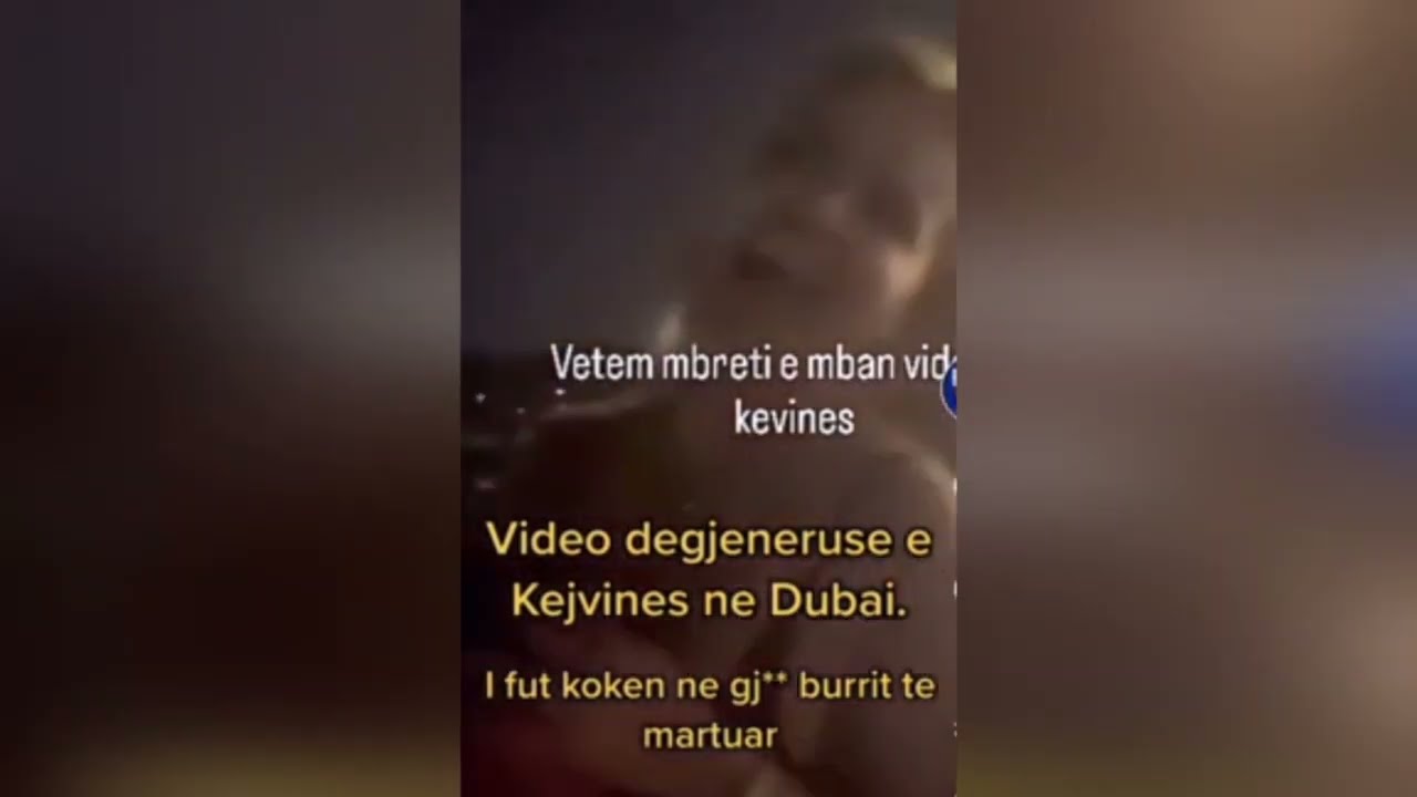 “Ule kokën se nuk të...”, Kejvina shfaqet nën shoqërinë e disa meshkujve, vendos tek gjoksi...