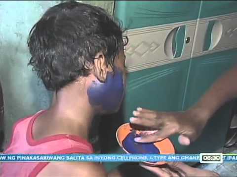 Unang Balita Health Watch: Myths and Facts About Mumps (Beke)