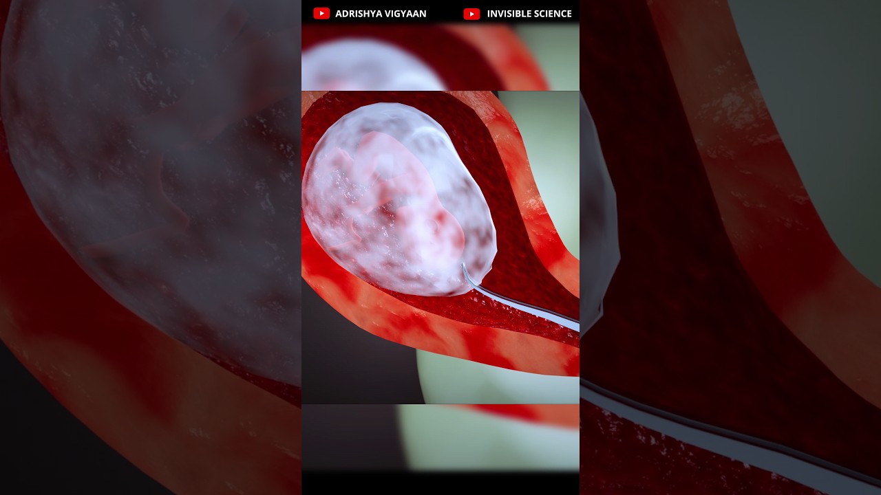 Understanding Abortion: 3D Animation Explaining D&E Procedures | Dilation and Evacuation