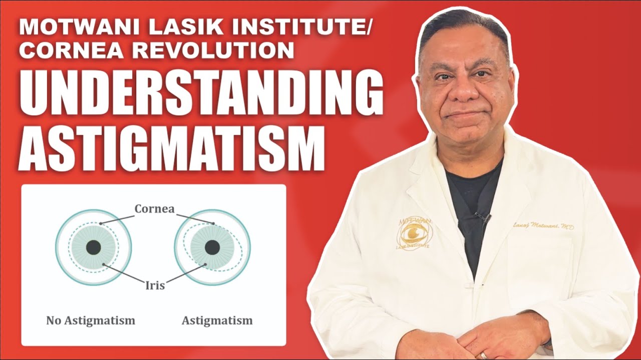 Understanding Astigmatism and How it Works
