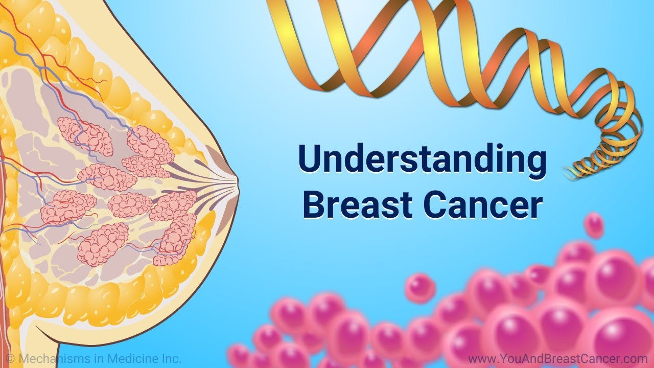 Understanding Breast Cancer