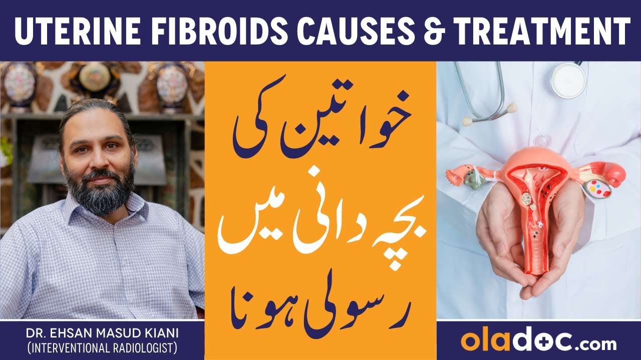 Uterine Fibroids Treatment - Bachedani Me Rasoli Kaise Hoti Hai- Fibroids Ka Ilaj - Fibroid Symptoms