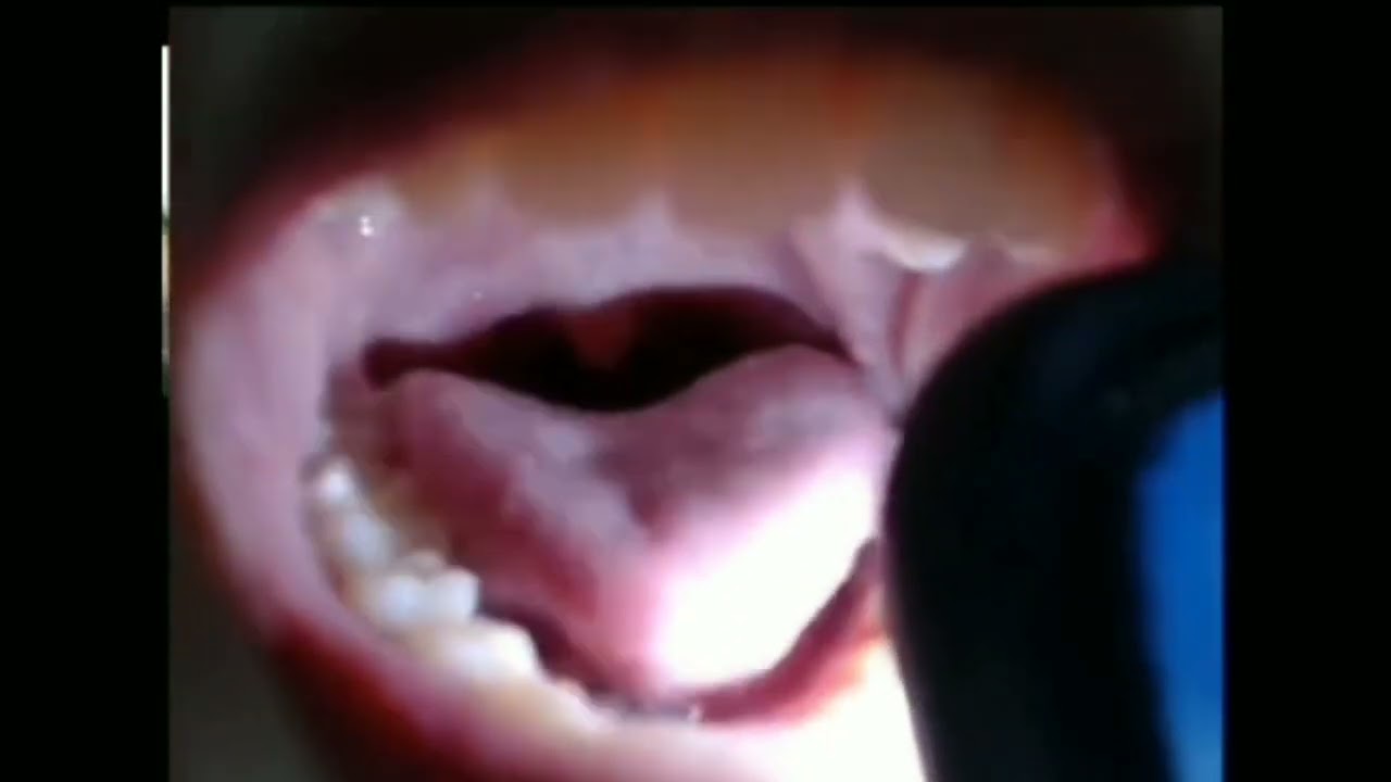 Valezka eat camera zoom mouth uvula