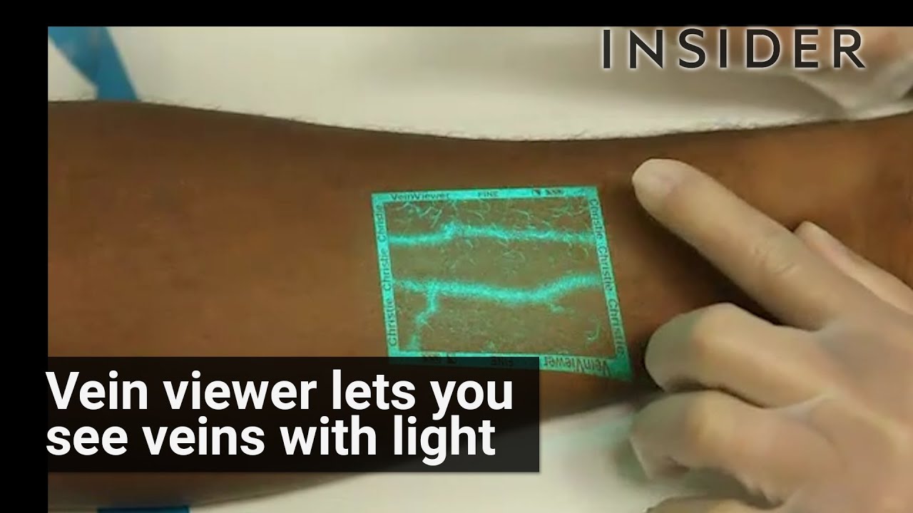 Vein Viewer