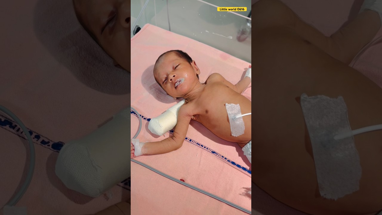Very very sick baby🥹#newbornbaby#newborncare#babyreview