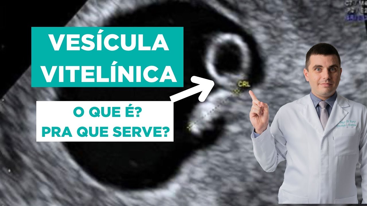 Vesícula Vitelínica - O Que É e Para Que Serve?