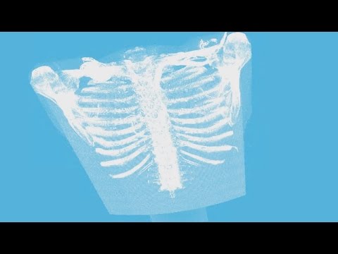 Volume Visualization App - MATLAB Video