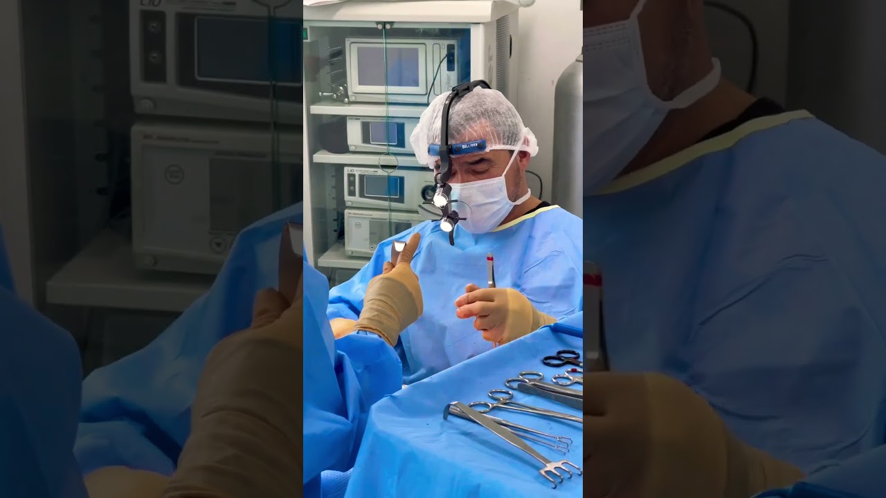 Watch 👨🏼‍⚕️Dr.Quiroz our #facelift #expert in #action 🙌 #certified #plasticsurgeons #beauty ✨